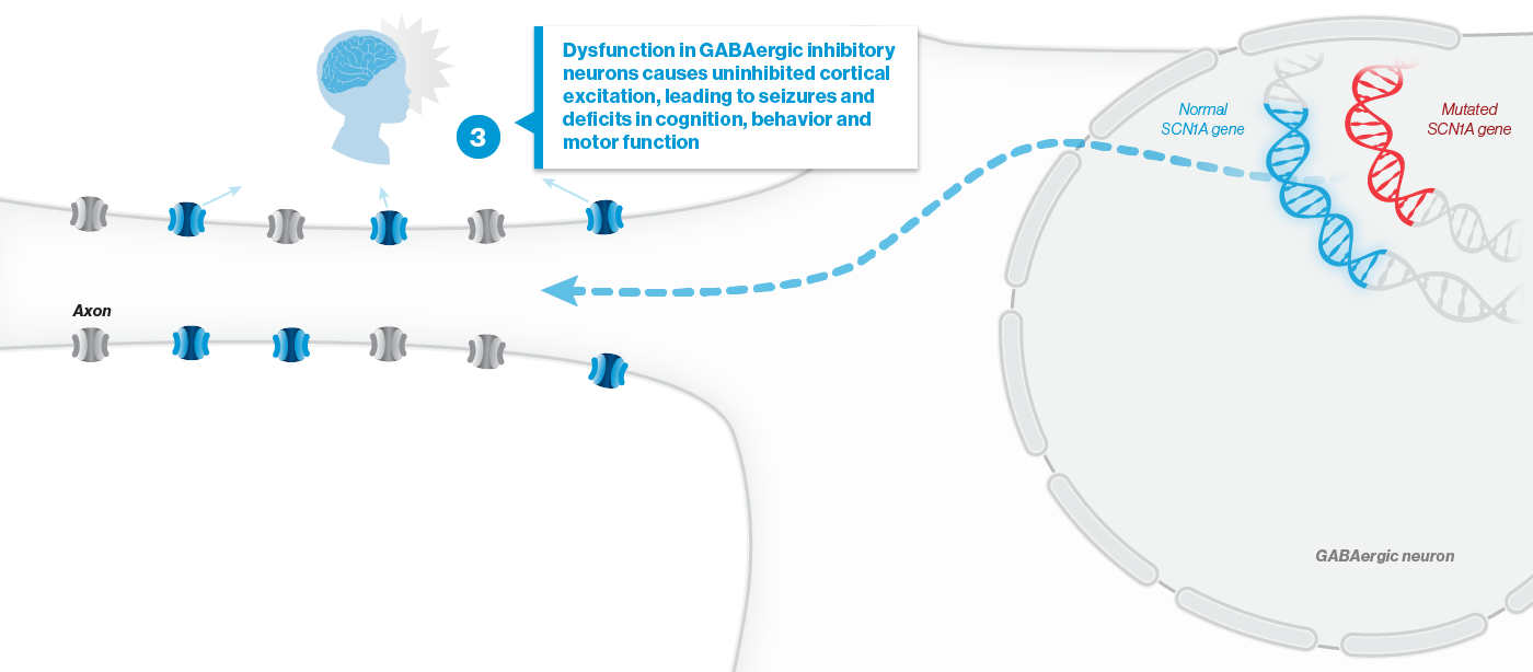 Dysfunction in GABAergic inhibitory neurons